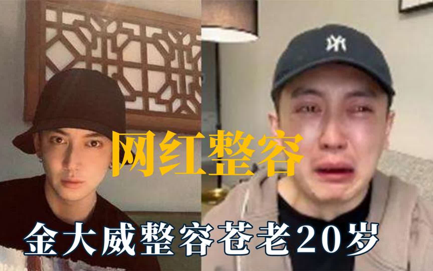 网红整容多离谱?医生让韩安冉往脑壳灌水泥,金大威整容苍老20岁哔哩哔哩bilibili