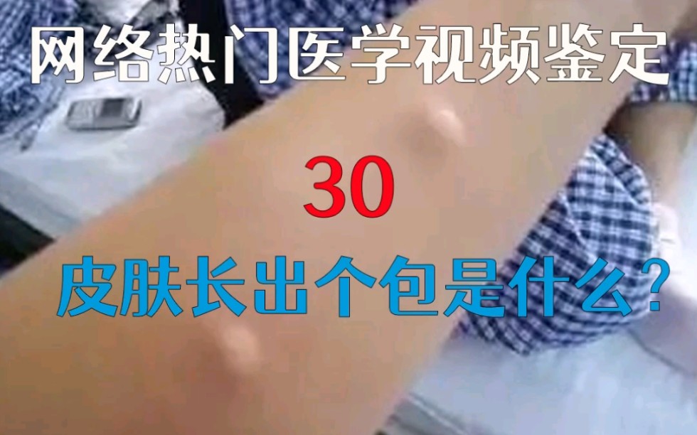 【医学鉴定30】皮肤长个大包是怎么回事?哔哩哔哩bilibili