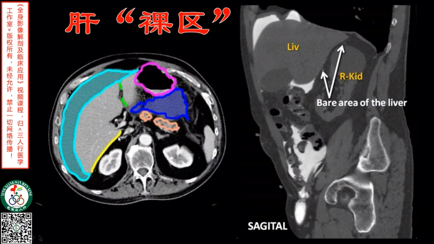 腹部——肝“裸区”哔哩哔哩bilibili