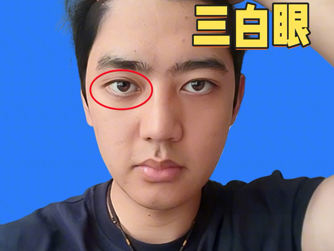 连心眉 金鸡啄印 很不好的面相特征!