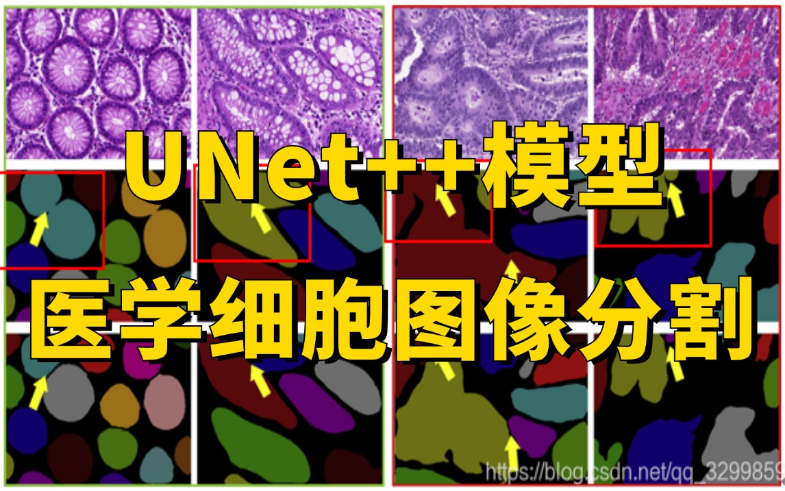 医学图像分割:基于Pytorch实现UNet++进行医学细胞图像分割,原理详解+代码精讲,究极通俗易懂!(深度学习/计算机视觉)哔哩哔哩bilibili