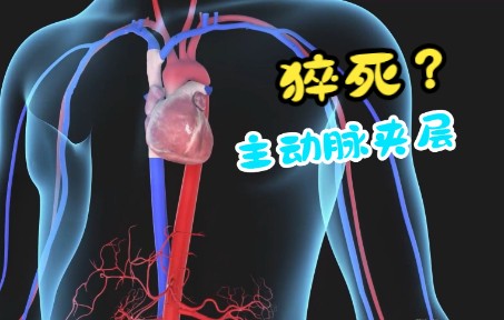 [图]【医学3D】主动脉瘤和主动脉夹层