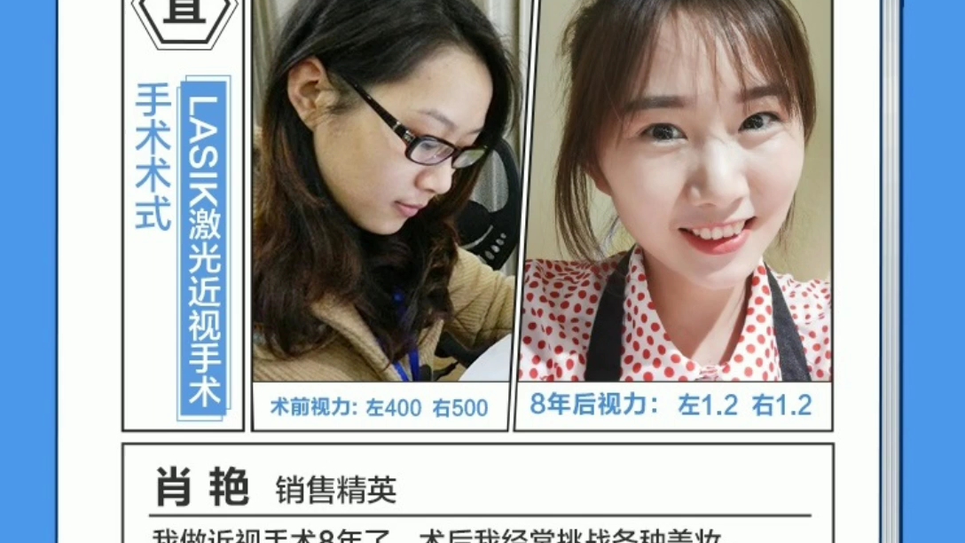 近视手术靠谱吗?来看他们的十年视力对比_哔哩哔哩_bilibili