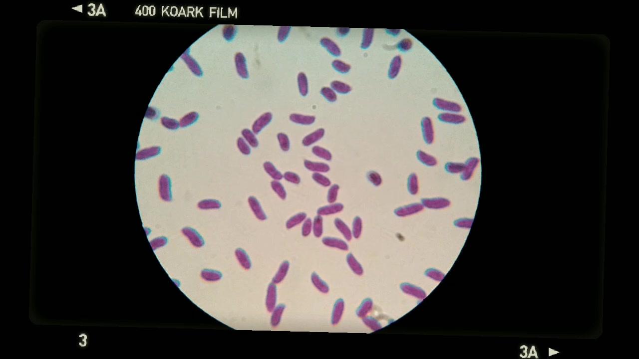 真菌孢子图片 显微镜图片