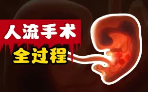 Tải video: 血肉横飞、千刀万剐！人流手术对女生伤害有多大？动画还原全过程