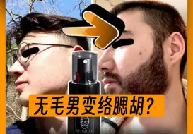 下载视频: 无毛男怎么变络腮胡？