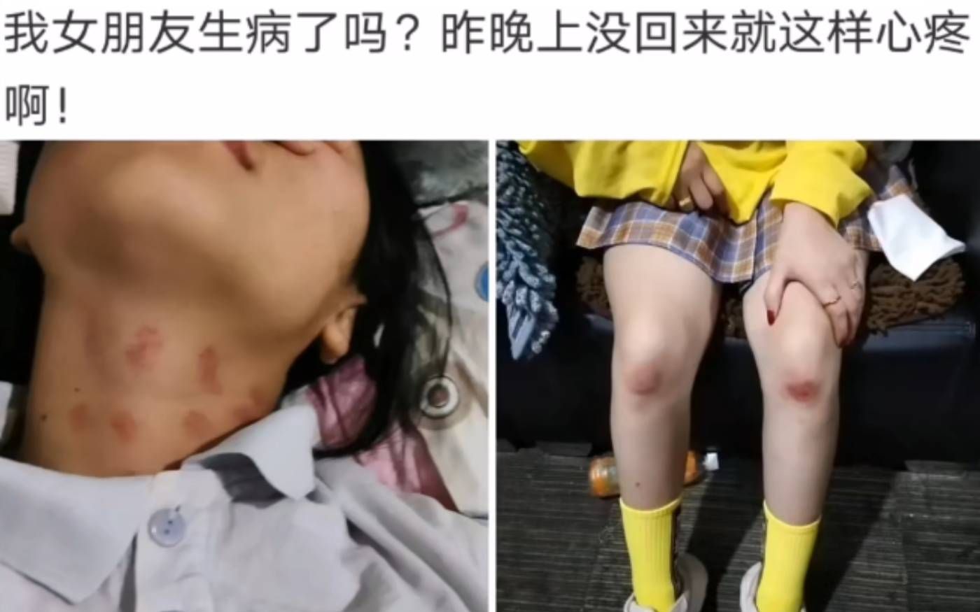 [图]女朋友这是生病了吗？