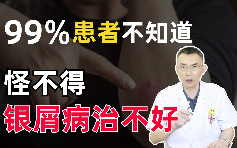 根据治疗银屑病30年经验总结出来的,今天免费分享,希望你们不要再走弯路了!哔哩哔哩bilibili