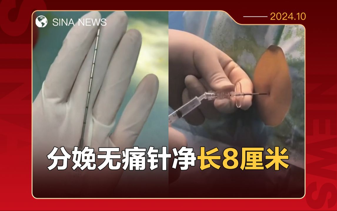 医护分享分娩无痛针全貌,长8厘米针头需刺入脊柱哔哩哔哩bilibili