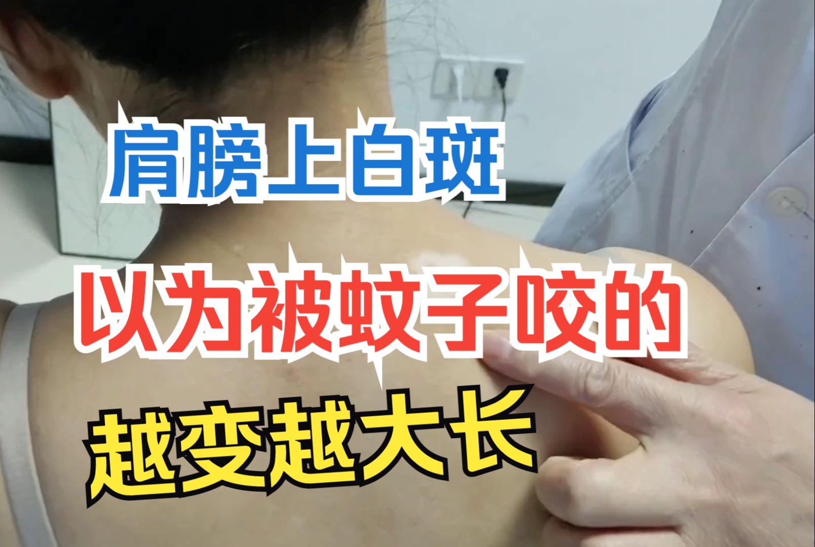 女子肩膀上白斑以为被蚊子咬的!越变越大长到脸上慌张求助!