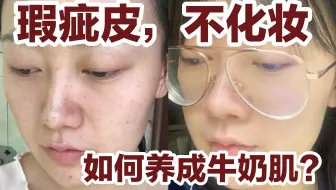 瑕疵皮不靠化妆如何养成牛奶肌？熬夜作死级UP现身说法快速修复皮肤心得