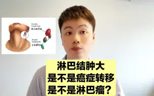 Download Video: 淋巴结肿大的常见原因有4个，医生教你判断是不是淋巴瘤！