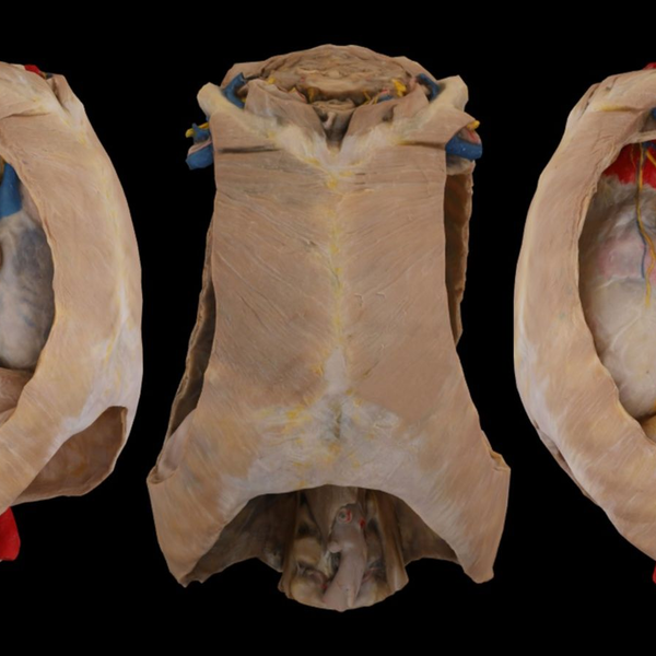 局部解剖学-胸部3（纵膈及其内容物）_哔哩哔哩_bilibili