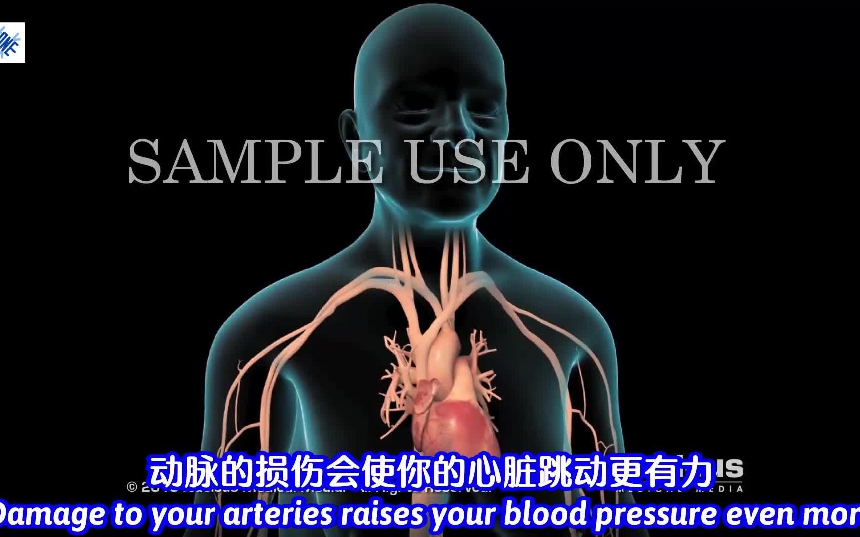 【TED科普】高血压是什么原因造成的，会引发哪些疾病，该怎么办？
