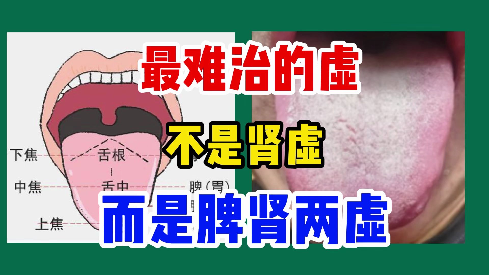 最难治的虚,不是肾虚,而是脾肾两虚