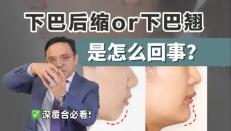 Download Video: 牙医解读：为什么有的深覆合下巴后缩，有的深覆合下巴翘？