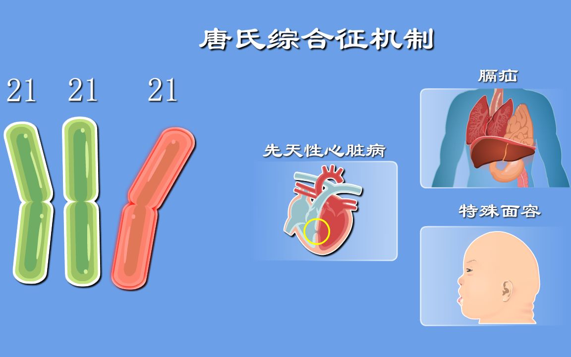 唐氏综合征2:为啥娃会得唐氏综合征哔哩哔哩bilibili