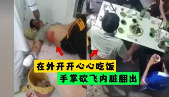 下载视频: 卧槽！开开心心吃饭被偷袭，手掌分离内脏爆出！