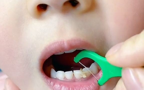 你给宝宝剔牙还用手指头吗?儿童专用牙线 安全更卫生