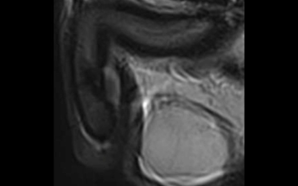 这是一期正经的男性生殖器MRI的科普视频(轴位矢状位冠状位)哔哩哔哩bilibili