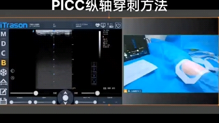 PICC置管纵轴穿刺方法及注意事项哔哩哔哩bilibili