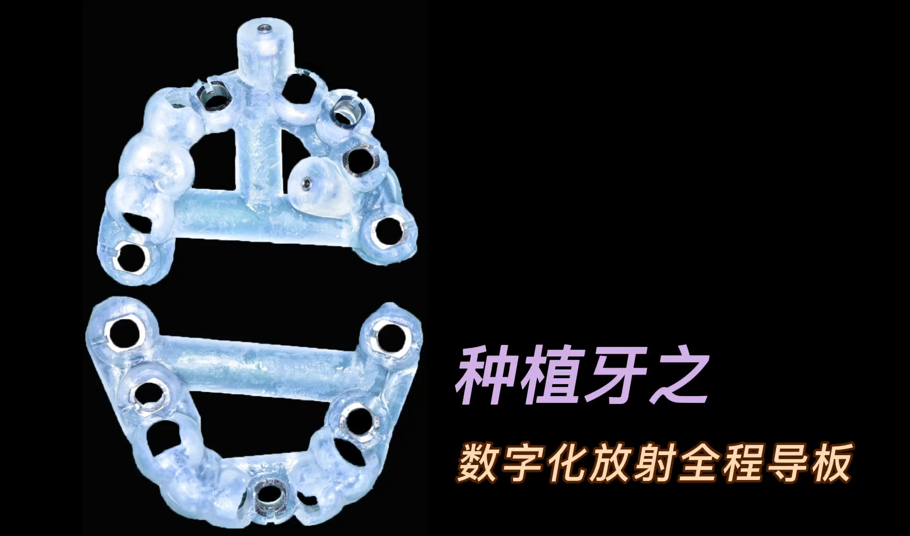 数字化放射种植导板 让种植更高效 让患者_哔哩哔哩_bilibili