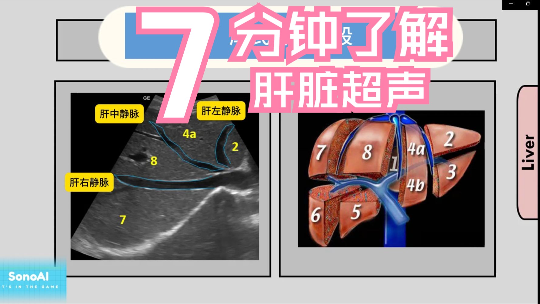 7分钟快速入门:肝脏超声实用基础教学视频标注+图解辅助+应用要点哔哩哔哩bilibili