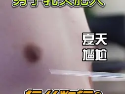 Télécharger la video: 男子乳头肥大 夏天穿衣难看