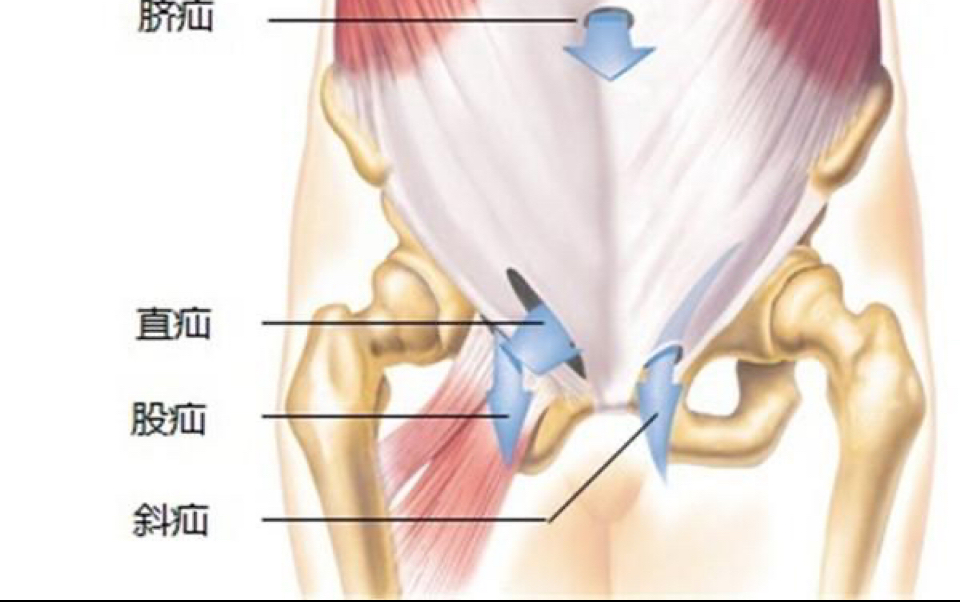 [图]【人解】5分钟了解腹股沟管和腹股沟疝