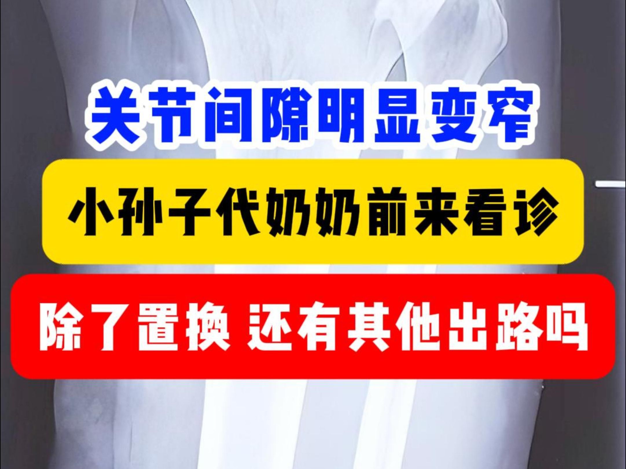 东直门中医院黄牛跑腿代挂-号贩子有偿代诊业务已开通疫情解决看病难题的简单介绍