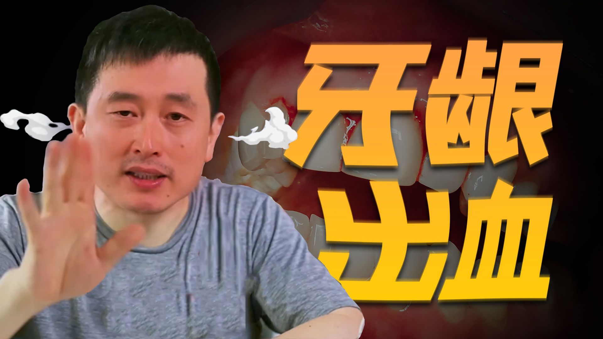 【口腔科普】电动牙刷会刷伤牙龈吗？