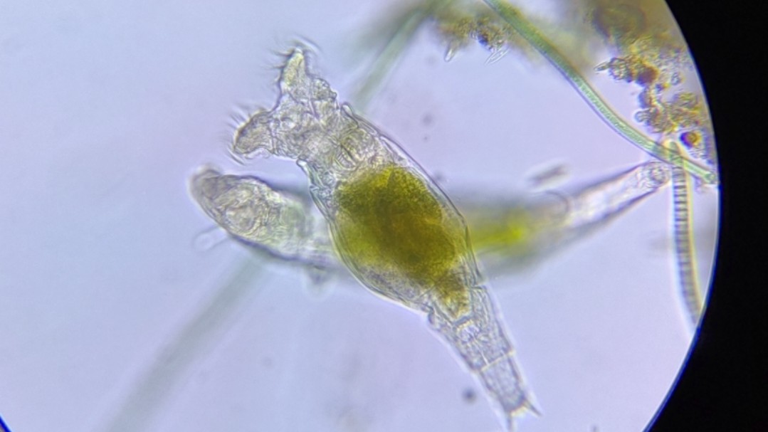 8月1日观察,暗场,轮虫?