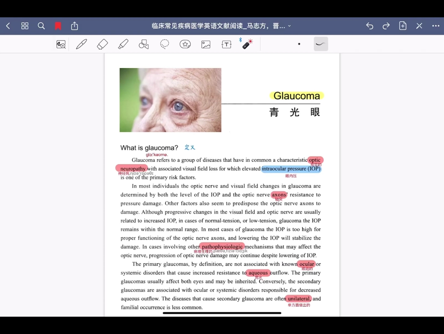 医学英语阅读青光眼哔哩哔哩bilibili