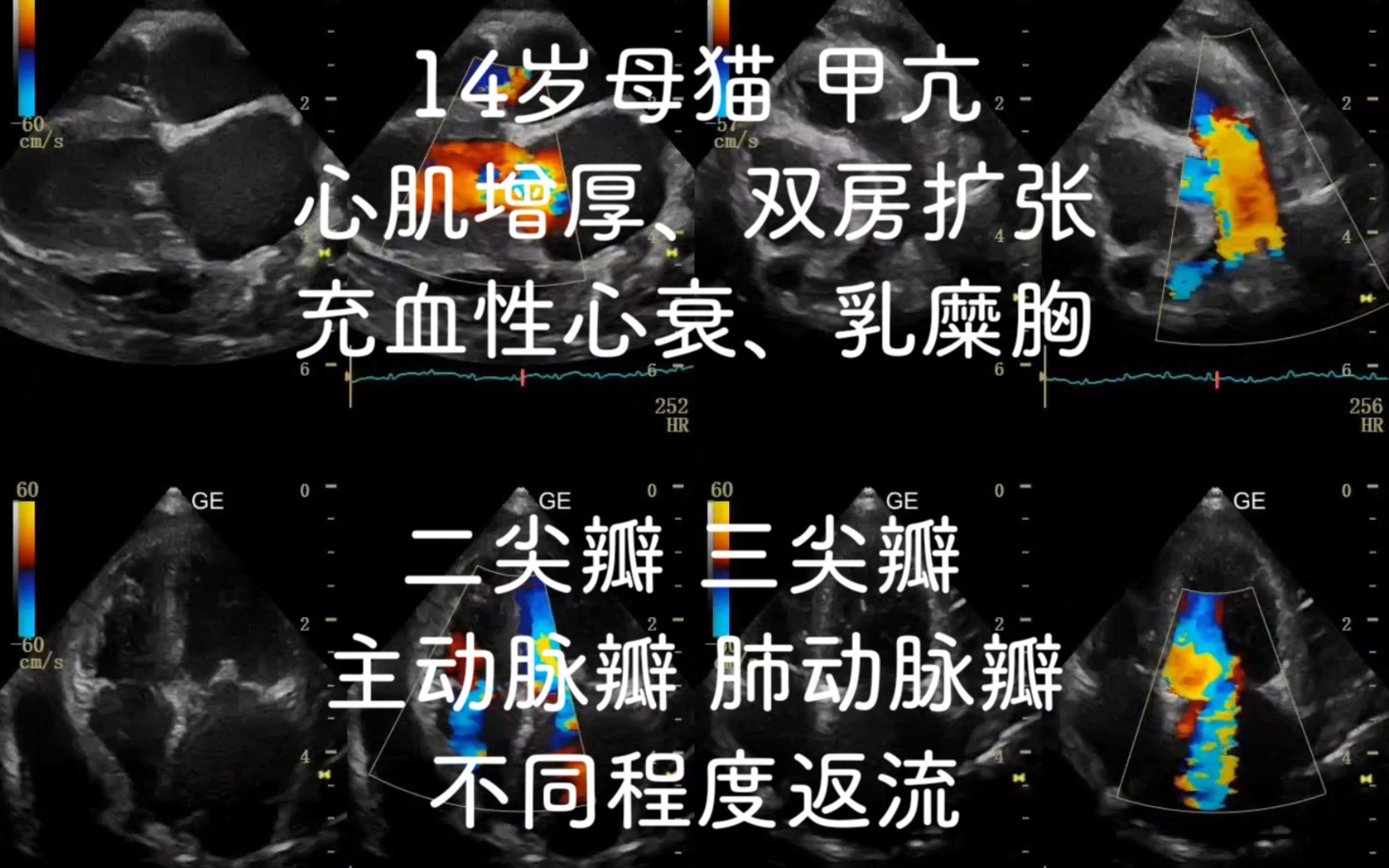 14岁母猫,甲亢导致充血性心衰、心肌增厚、双房扩张、胸腔积液(乳糜胸)、二尖瓣 三尖瓣 主动脉瓣 肺动脉瓣均有不同程度的返流,非常经典的超声影...