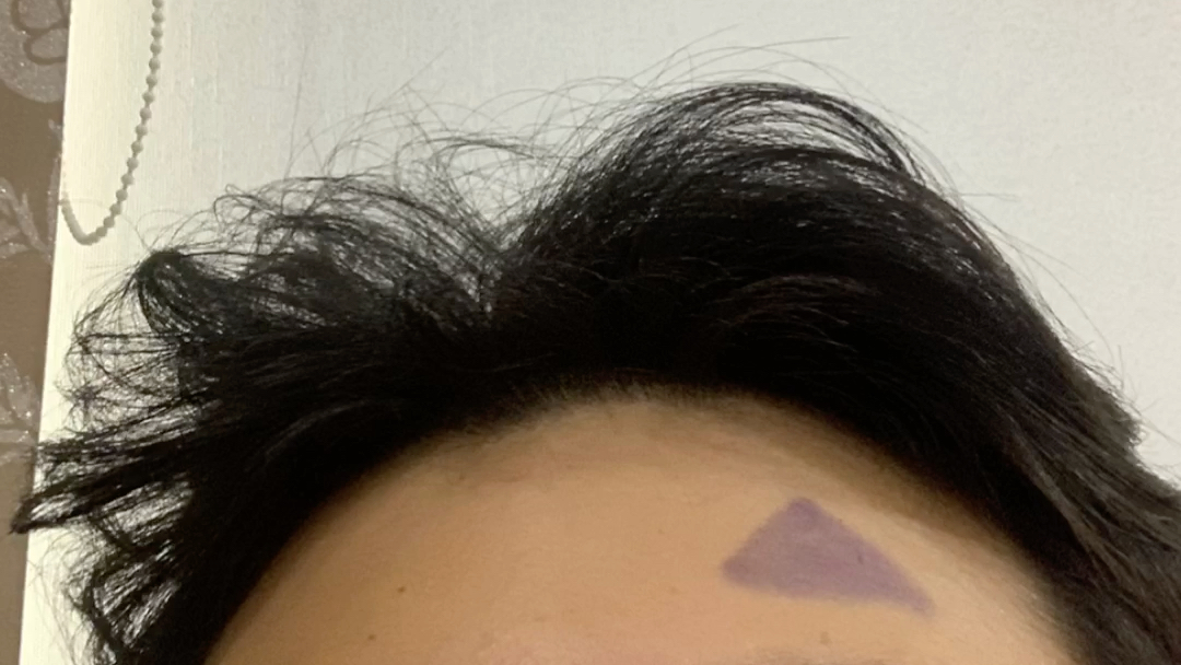 手术完了开启斑纹