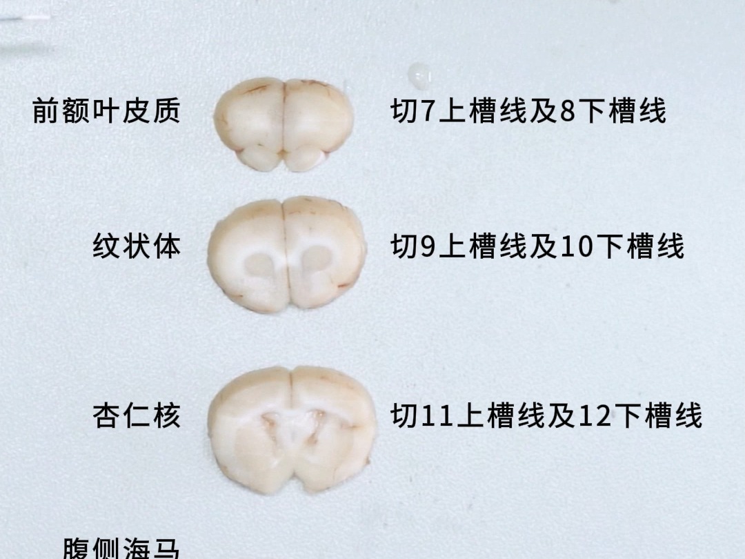 大小鼠脑切片,如何部位精确且切口平齐?哔哩哔哩bilibili