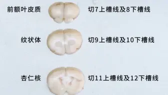 大小鼠脑切片，如何部位精确且切口平齐？