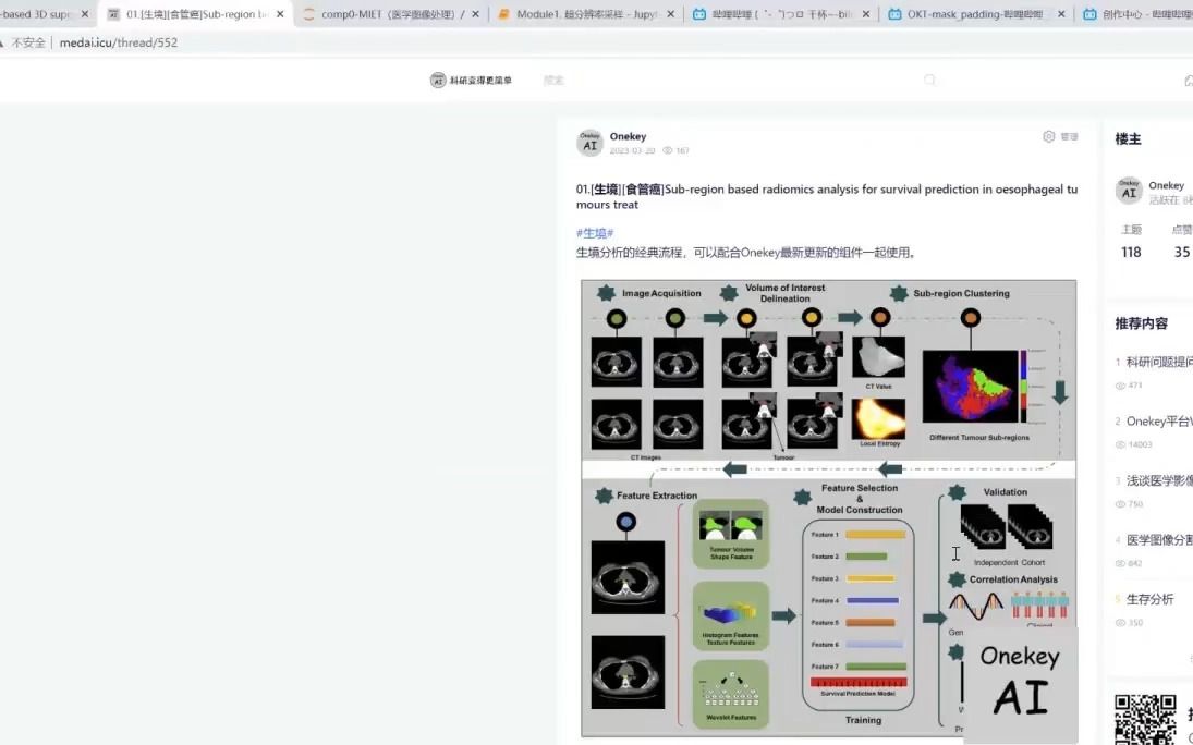 影像组学超分辨率重建在多发性硬化症MRI图像增强哔哩哔哩bilibili