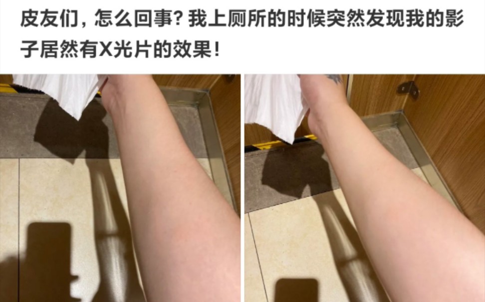 [图]每日神评：我的影子居然有X光片的效果！