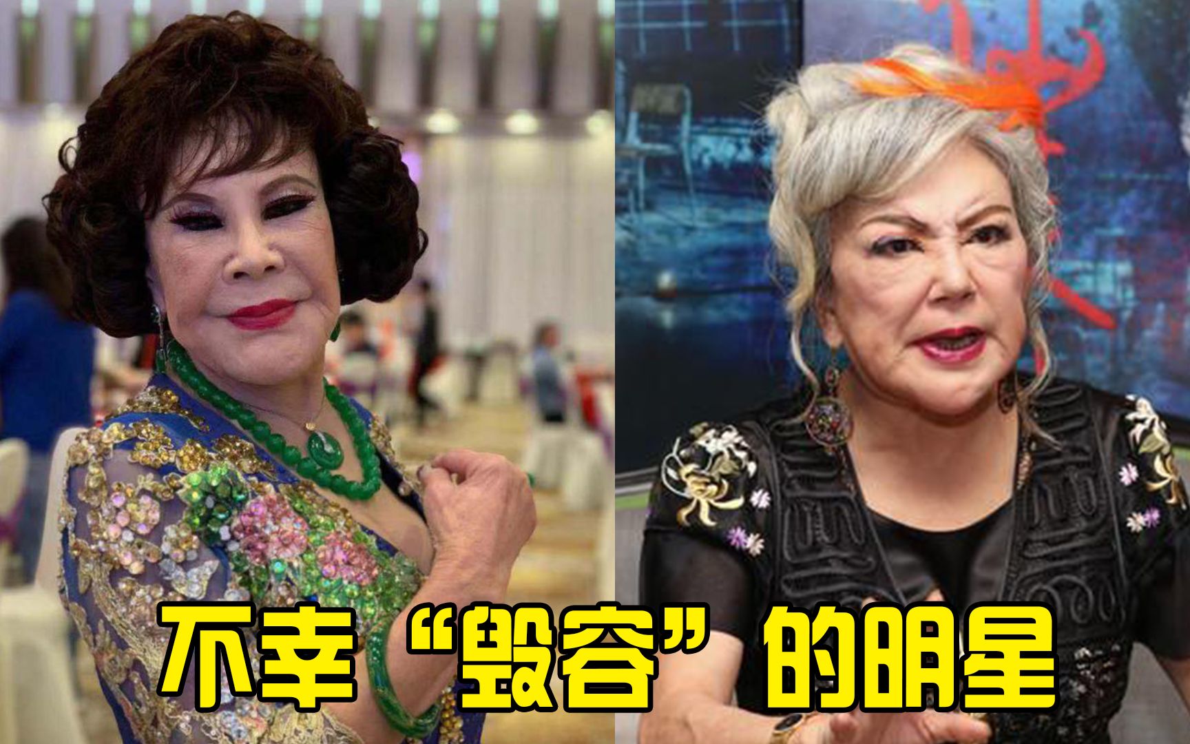 不幸毁容的明星,邵音音黄夏蕙曾吓跑小偷,胡歌阿娇令人感到惋惜