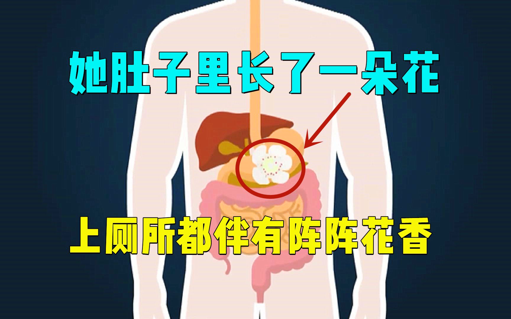 [图]大妈肚子里长了一朵花，花瓣清晰可见 ，医生直呼不可能