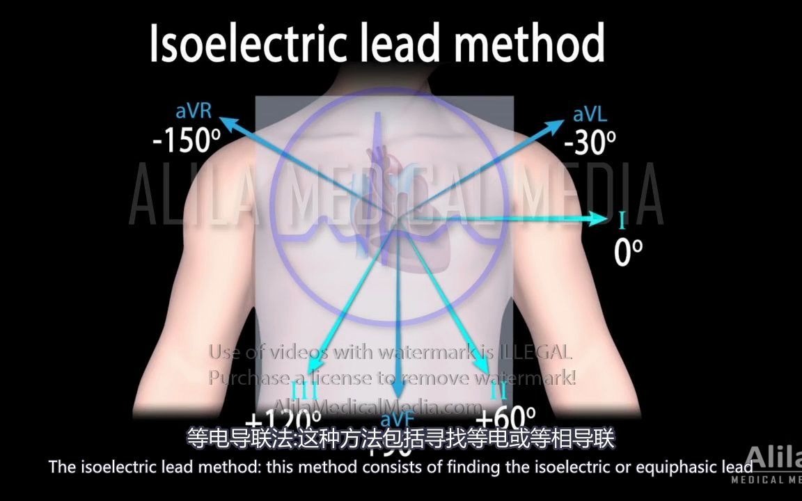 【Alila Medical Media】12.心电轴简介哔哩哔哩bilibili