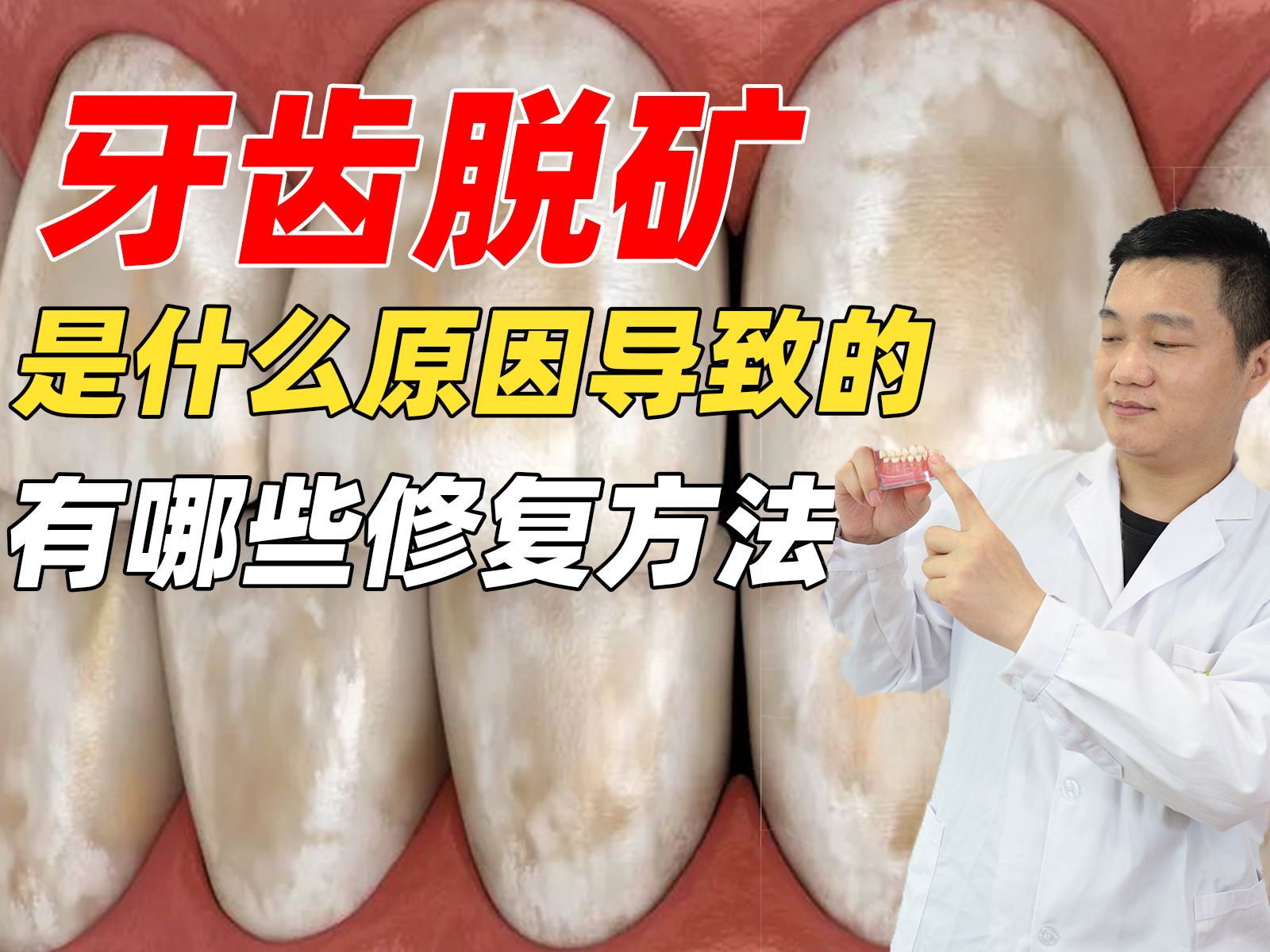 牙齿脱矿有哪几种修复方法?