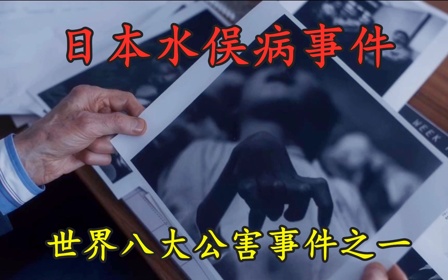 日本水俣病事件:堪比现实版丧尸病毒的水俣病有多可怕?哔哩哔哩bilibili