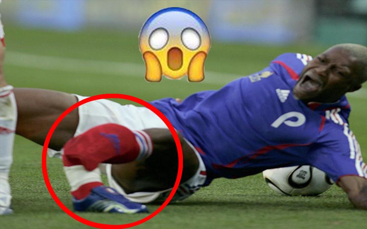 【慎入】最严重的运动损伤top15 ft. cissé, eduard