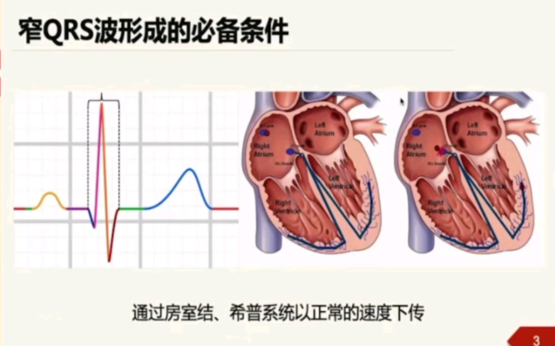 【心电图第二弹】相关电生理知识哔哩哔哩bilibili