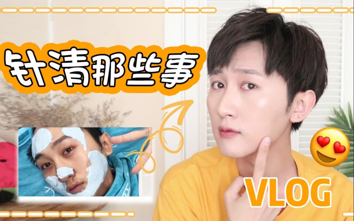 【vlog—针清那些事】针清真的管用吗?能有效消除闭口粉刺吗?哔哩哔哩bilibili