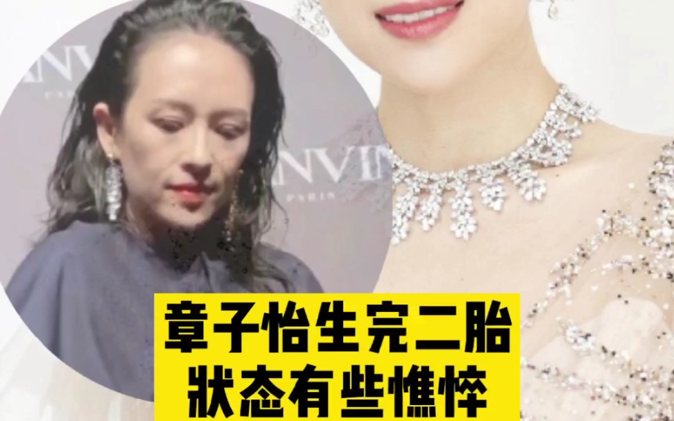 章子怡生完二胎后状态大不如从前整个人苍老憔悴的不像话发际线更是