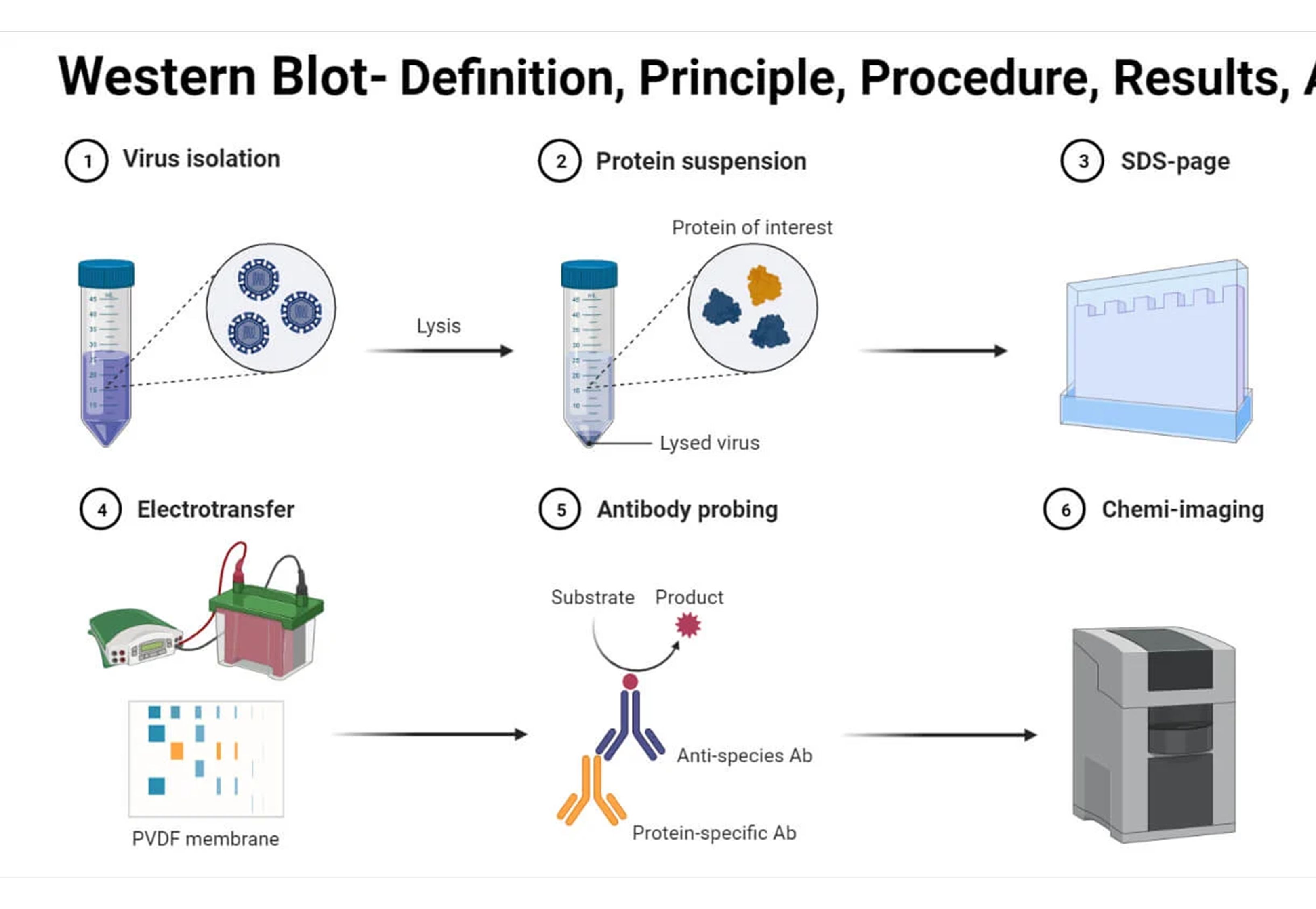 Western blot full protocol: Protein extraction to chemiluminescence