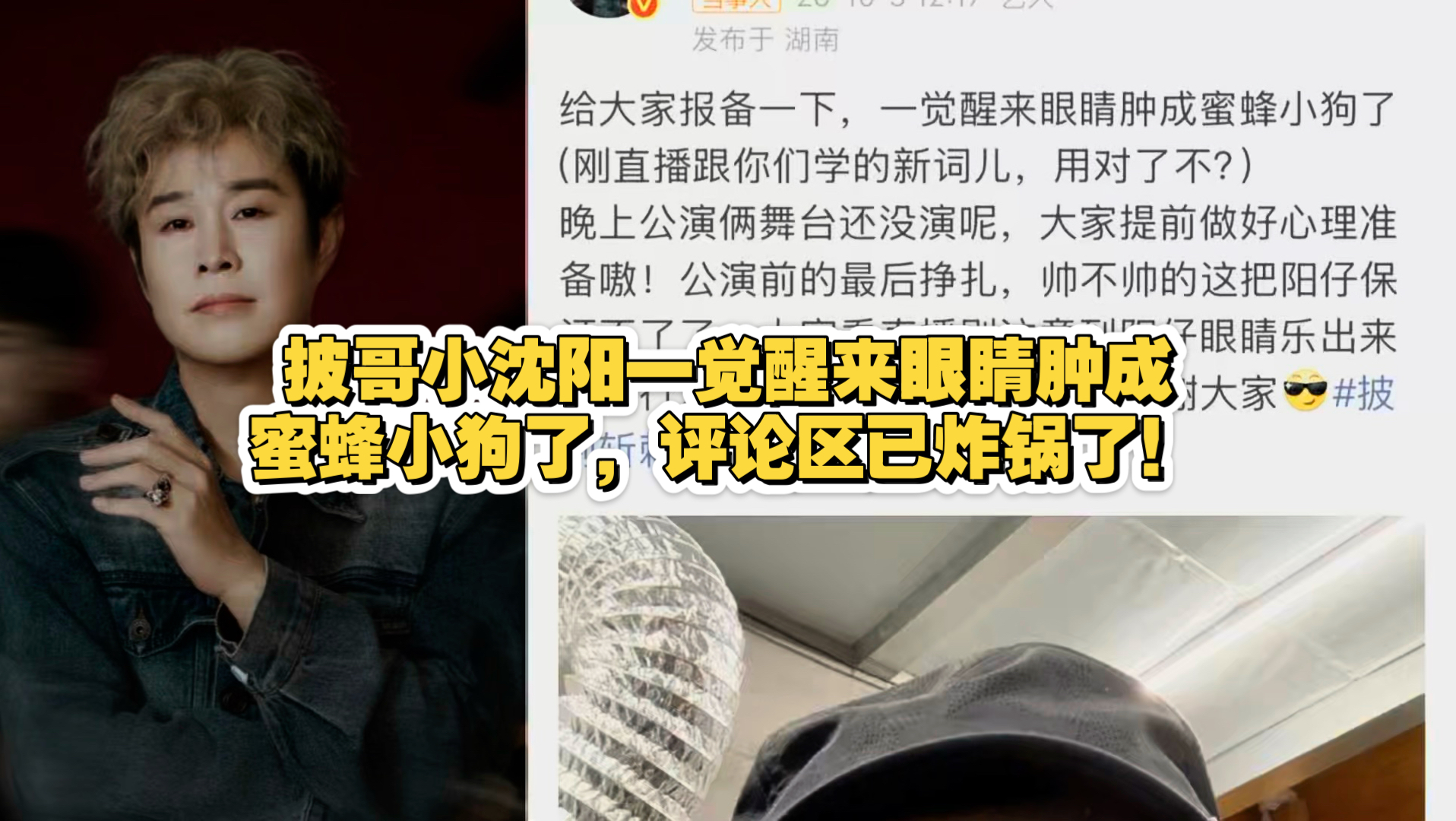 披哥小沈阳一觉醒来眼睛肿成蜜蜂小狗了，评论区已炸锅了！